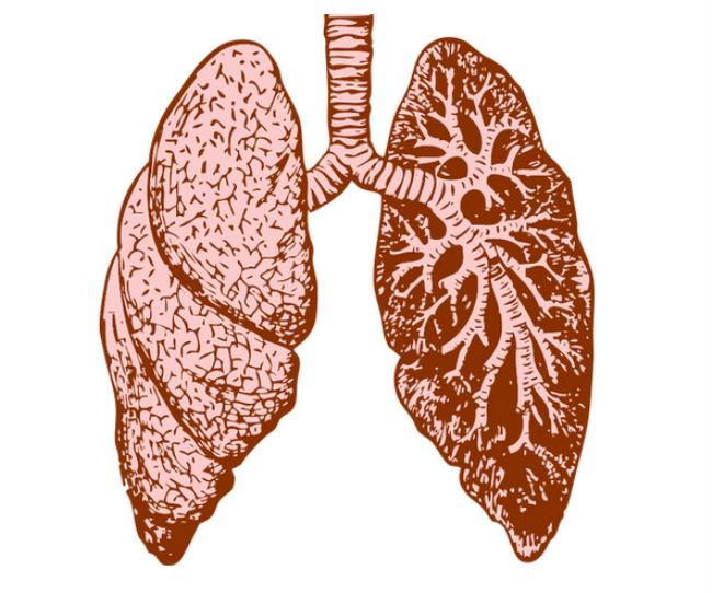 肺部纤维化是什么意思