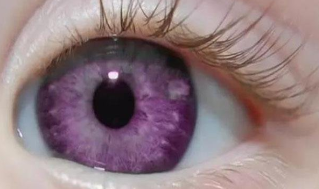 世界上最罕见的眼睛颜色（世界四大罕见眼睛颜色是什么）-第1张图片