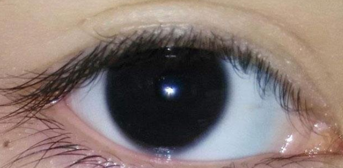 世界上最罕见的眼睛颜色（世界四大罕见眼睛颜色是什么）-第4张图片